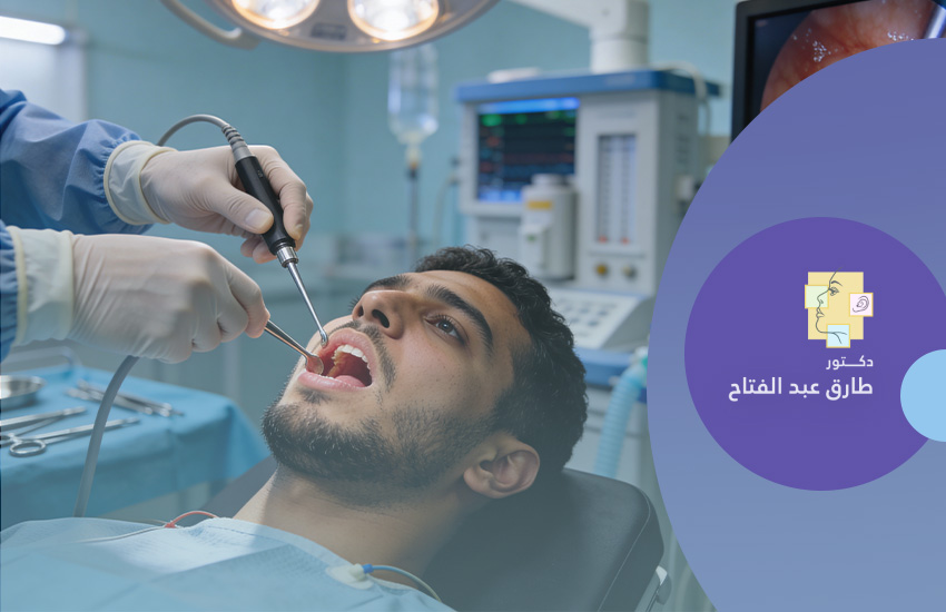 إستئصال اللوزتين و اللحمية  خلف الانف