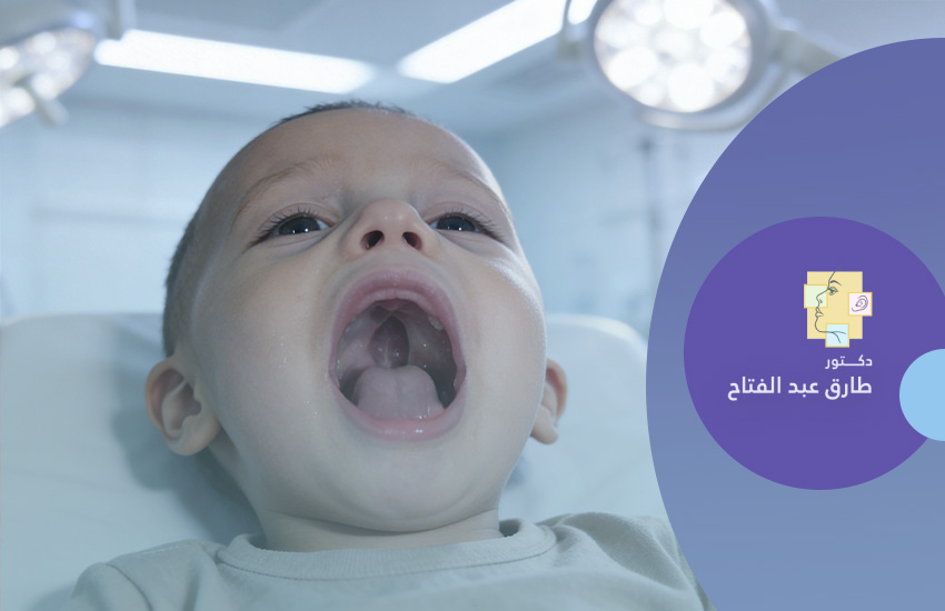 السن المناسب لعملية اللوزتين