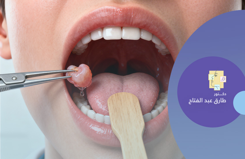 فتح خراج حول اللوزة