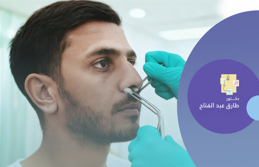 كى الشعيرات الدموية لعلاج نزيف الأنف