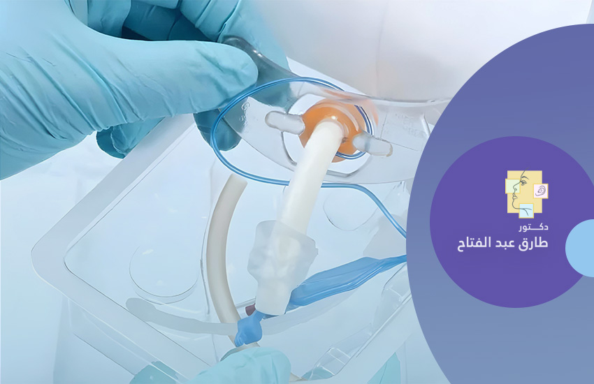 تغيير أنبوب الشق الحنجرى