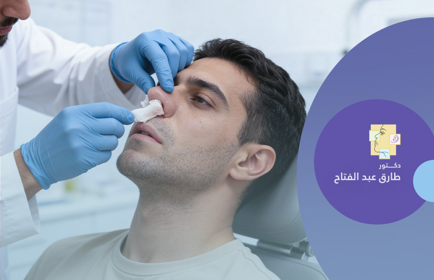 حشو أنف أمامى لوقف النزيف  