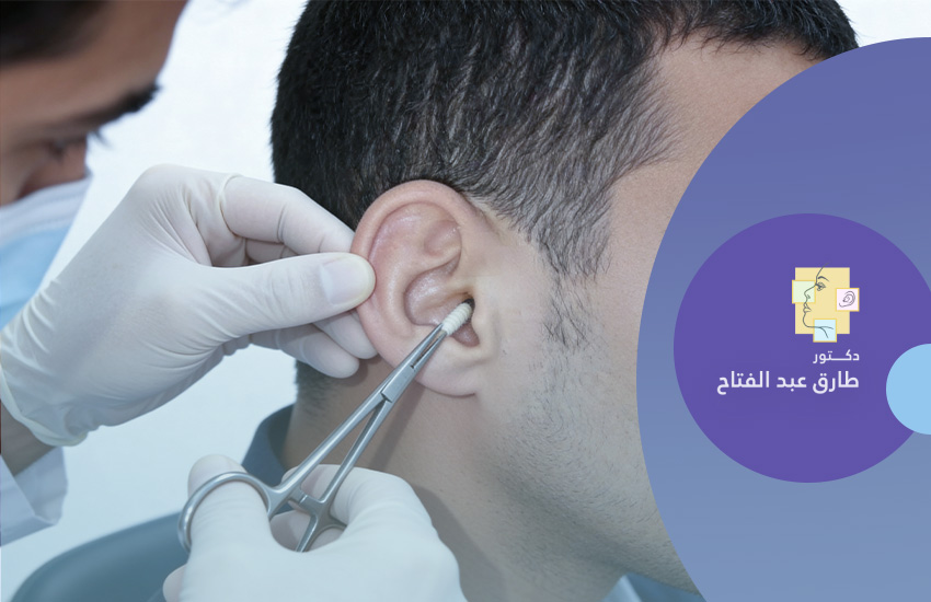 فتيل ( حشو الأذن )