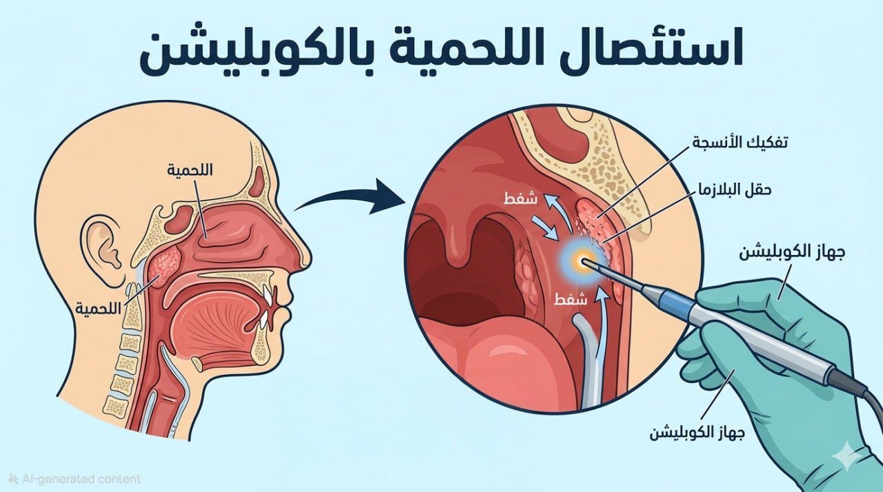 وداعاً لألم الحلق المتكرر: دليلك الطبي الشامل للوقاية من التهاب اللوزتين